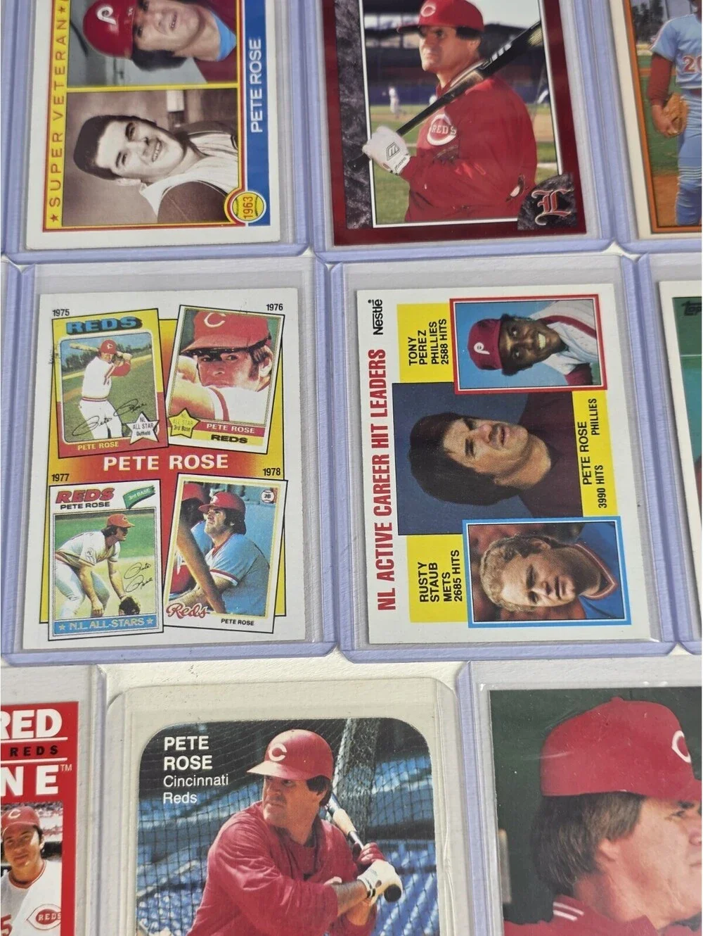 N/A pete rose